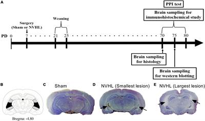 Alterations in prefrontal cortical neuregulin-1 levels in post-pubertal rats with neonatal ventral hippocampal lesions